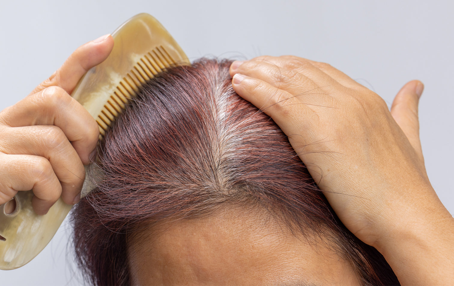 8 Ways to Tell if Your Hair Is Thinning Before It's Too Late
