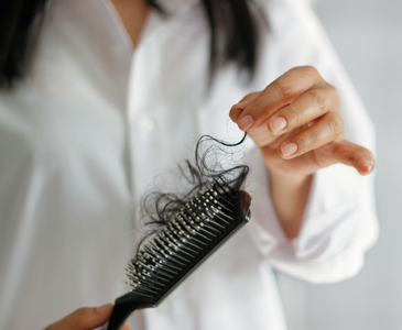 Causes of Hair Loss