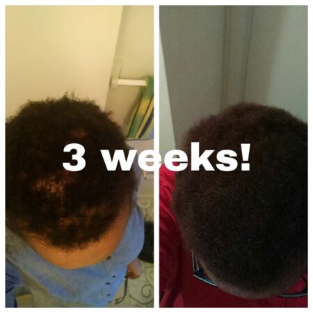 Growin Hairris