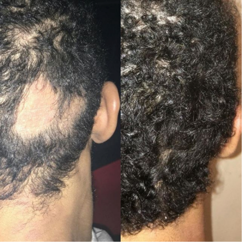 Hairfinity User