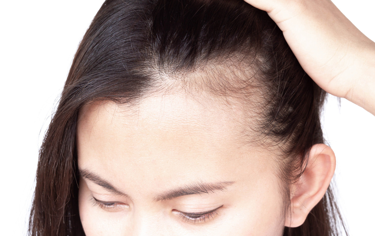 When You See These Early Signs of Hair Loss, Act Fast