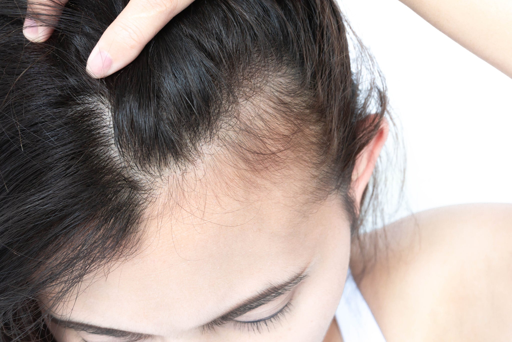 How can I stop hair loss and regrow hair naturally?