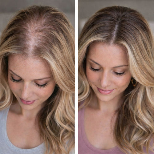 Hairfinity customer before and after result