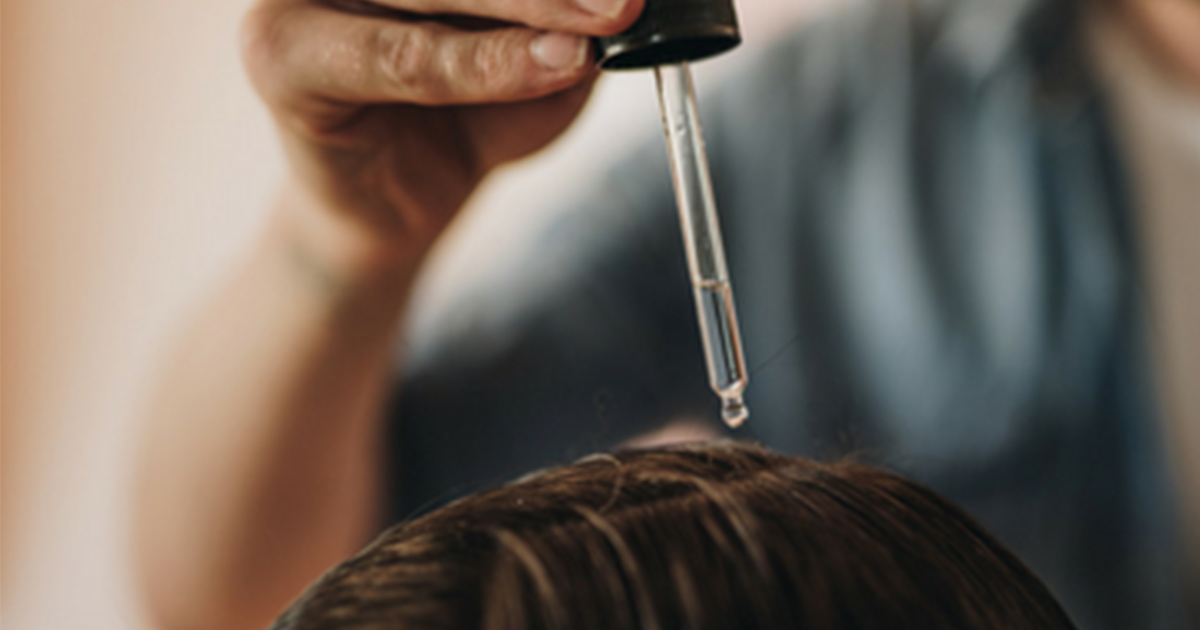 How to Treat Chemical Burns on the Scalp Hairfinity