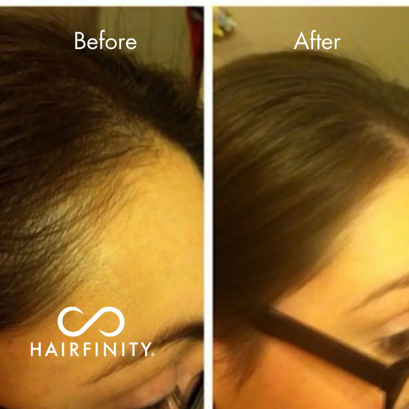 Edges Growth Kit Hairfinity
