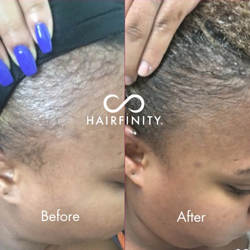 Edges Growth Kit Hairfinity