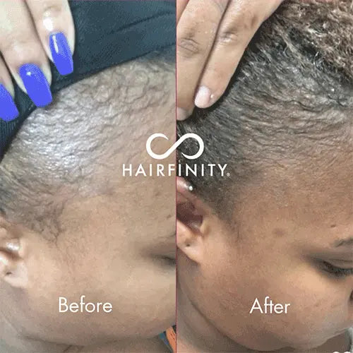 Infinite Edges Serum - 15ml Hairfinity